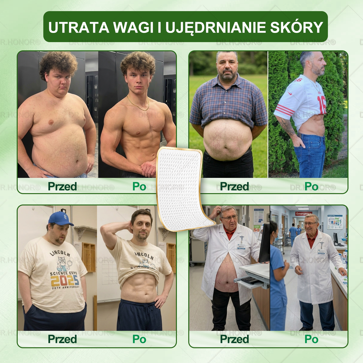 👨‍⚕‍𝐃𝐑.𝐇𝐎𝐍𝐎𝐑® drenujący limfatycznie nano-mikroigłowy plaster wyszczuplający: ultra mocna formuła 𝟓× z lipolitycznym kompleksem peptydowym — wspiera odchudzanie i krążenie limfatyczne, a także pomaga zadbać o komfort stawów, lepszy sen i jasność umysłu🍀