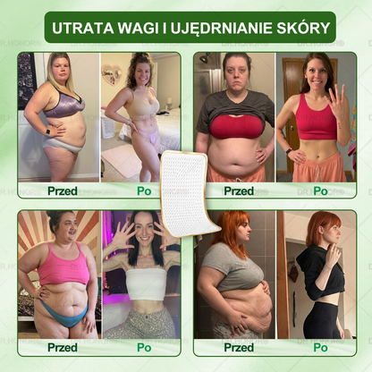 👨‍⚕‍𝐃𝐑.𝐇𝐎𝐍𝐎𝐑® drenujący limfatycznie nano-mikroigłowy plaster wyszczuplający: ultra mocna formuła 𝟓× z lipolitycznym kompleksem peptydowym — wspiera odchudzanie i krążenie limfatyczne, a także pomaga zadbać o komfort stawów, lepszy sen i jasność umysłu🍀