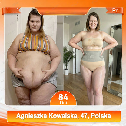 ✅ Oficjalny sklep marki 👩 Nowość Kkio® 2026 – 4 w 1 plastry mikroigłowe modelująco-liftingujące z moringą i berberyną oraz szybkoschnące spodenki termogeniczne