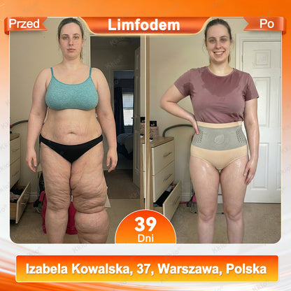 ✅ Oficjalny sklep marki 👩 Nowość Kkio® 2026 – 4 w 1 plastry mikroigłowe modelująco-liftingujące z moringą i berberyną oraz szybkoschnące spodenki termogeniczne