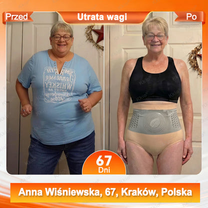 ✅ Oficjalny sklep marki 👩 Nowość Kkio® 2026 – 4 w 1 plastry mikroigłowe modelująco-liftingujące z moringą i berberyną oraz szybkoschnące spodenki termogeniczne