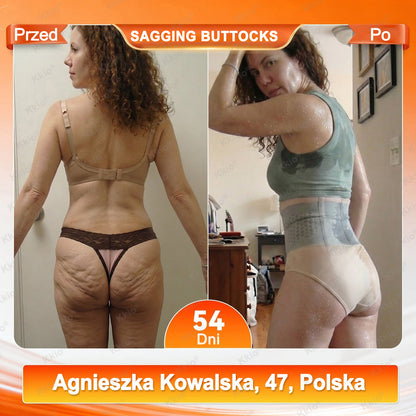 ✅ Oficjalny sklep marki 👩 Nowość Kkio® 2026 – 4 w 1 plastry mikroigłowe modelująco-liftingujące z moringą i berberyną oraz szybkoschnące spodenki termogeniczne